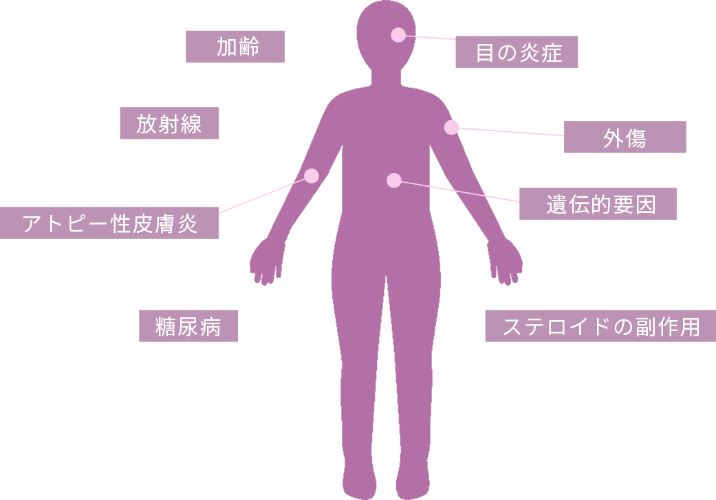 白内障の原因